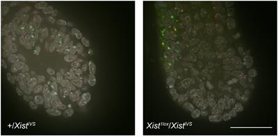 Ectopic Splicing Disturbs the Function of Xist RNA to Establish the Stable Heterochromatin State